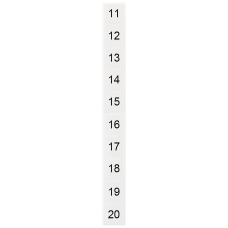 Labeling plate, front, with 11-20, horizontal, terminal width: 10.2 mm